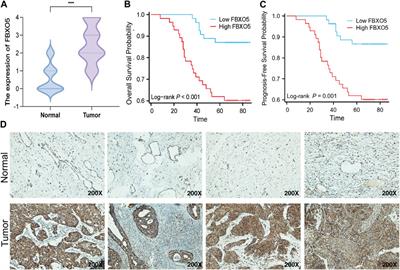 Frontiers | FBXO5 Acts As A Novel Prognostic Biomarker For Patients ...